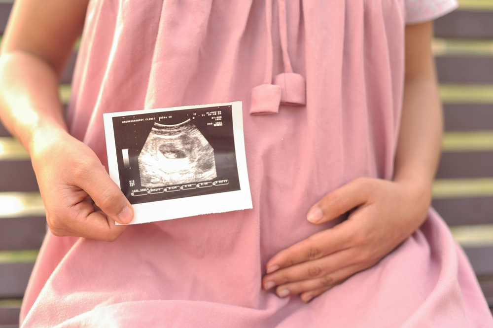 Bilde av en dame med gravidmage som holder et ultralydbilde