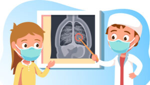 Røntgenbilde av lunger. Lege peker på bildet.