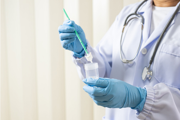 En lege som holder en livmorhals celleprøve børste over et prøveglass