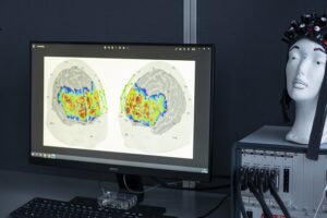 Pc skjerme med fargebilder av to hjerner. På høyre side en gipsfigur av et hode.