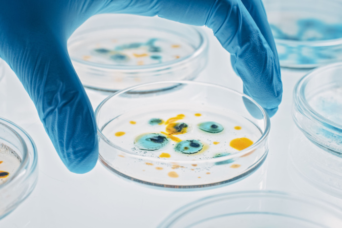 Bakterieskål med oppvekst av bakterier blir hold av en hånd med blå handske
