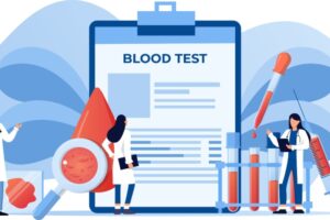 Illustrasjon fra laboratorie, som viser analyse av blod