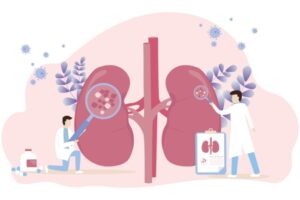 Illustrasjonsbilde som viser to anatomiske nyrer, hvor to helsepersonell står med hvert sitt forstørrelsesglass og undersøker disse. Bildet er ment å illustrere diagnostisk undersøkelse av nyrer.