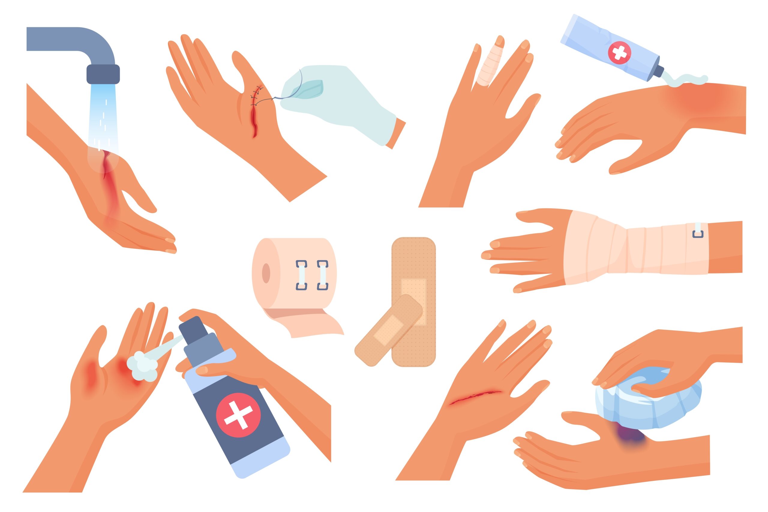 First,Aid,For,Hand,Injury,Set,Vector,Illustration.,Cartoon,Isolated illustrasjon av hender med diverse sår-skader. Noen bandasjerte hender, noen hender vaskes