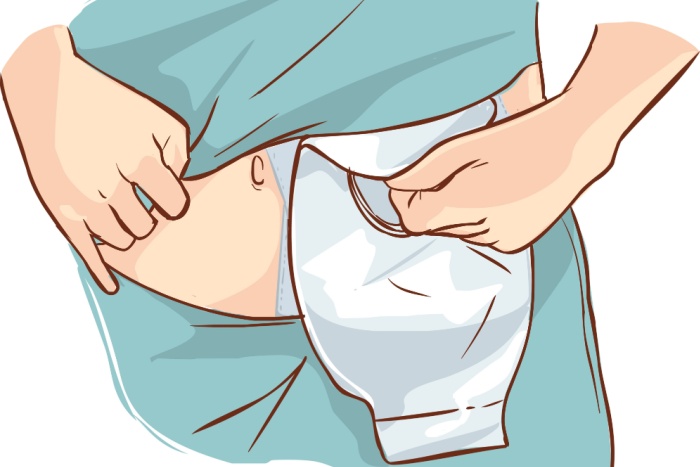 Illustrasjon stomi, Shutterstock