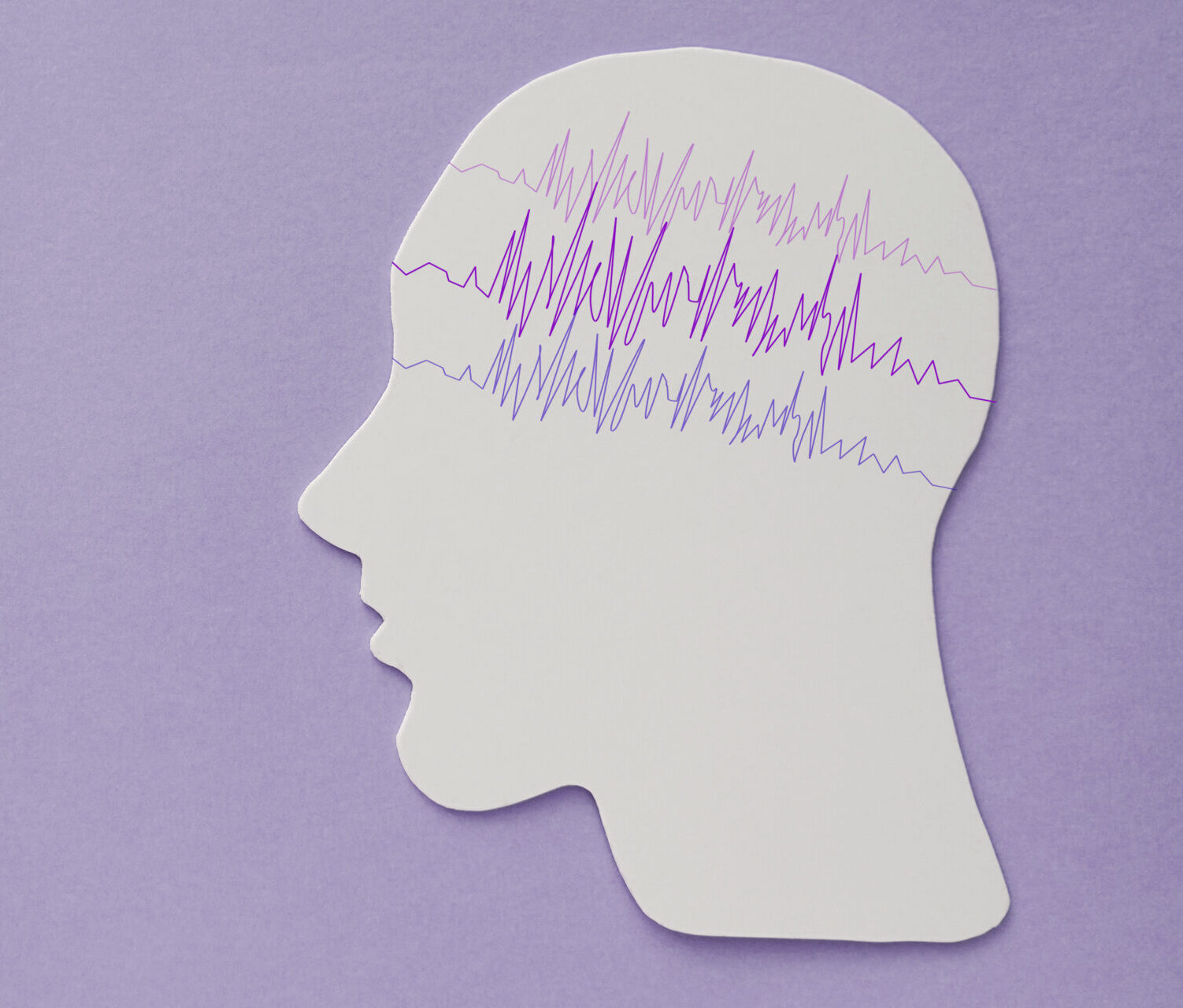Encephalography,Brain,Paper,Cutout,With,Purple,Ribbon,,Autism,,Epilepsy,Awareness, utklipp, illustrasjon, i sammenheng med epilepsi, epileptiske anfall. Menneskehode i profil på en lillla bakgrunn, frekvenser illustrert i hjernen