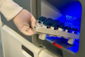 Bilde av hvitkledd arm med steril hanske som holder et brett bed prøvekolber i nærheten medisinsk teknisk utstyr i form av analyseapparat.