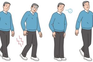 Illustrasjon av middelaldrende mann med claudicatio intermittens