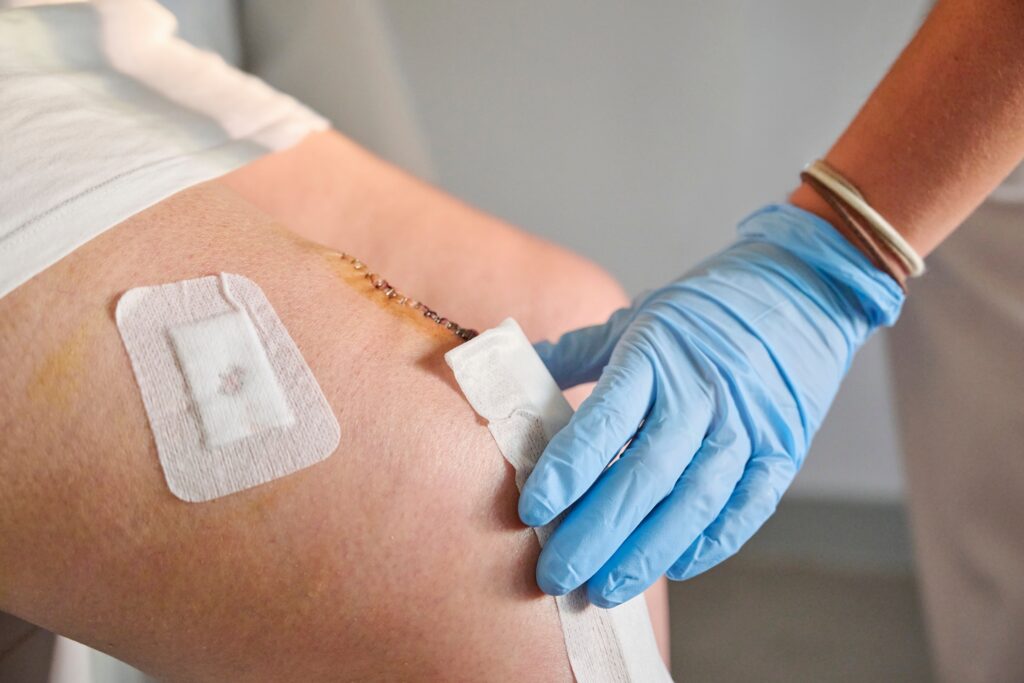 Bilde viser en sykepleier som skifter plaster på et operasjonssår.