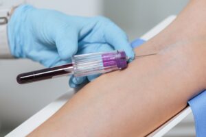 Blodprøvetaking. Hanskekledd hånd som samler blod fra pasientens arm.